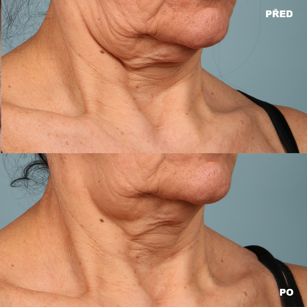 strivectin_face_and_neck_cream_PLUS_aurio_pred_po